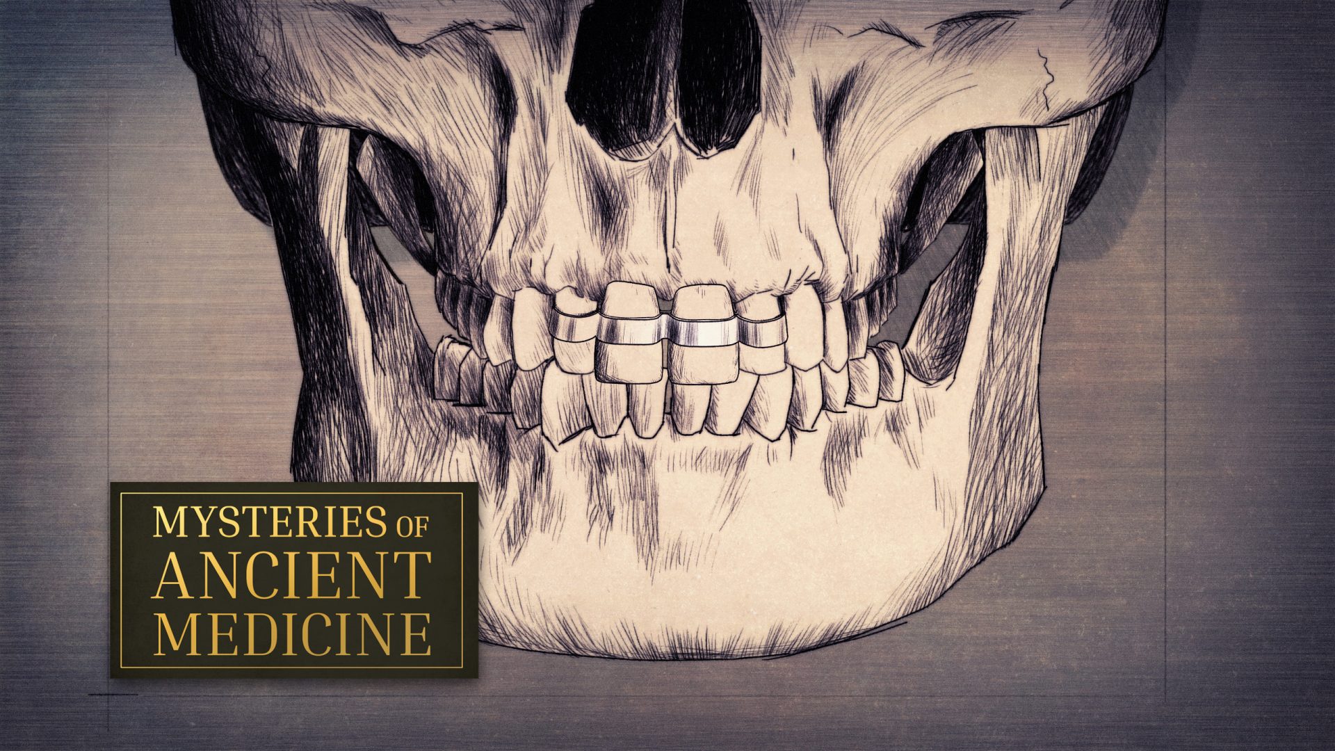 Mysteries of Ancient Medicine